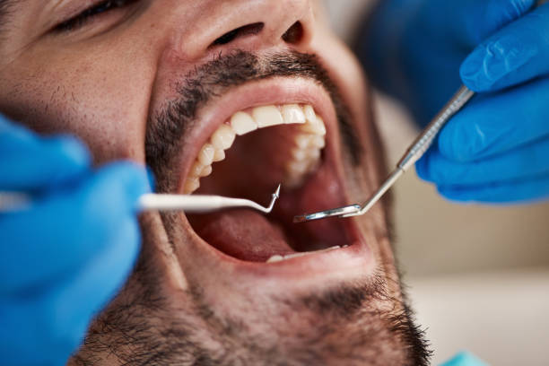 Best Emergency Dental Extractions in Sargent, TX