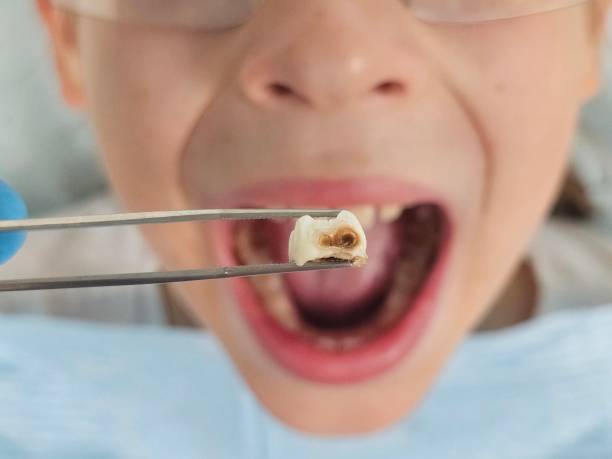 Best Pediatric Emergency Dentist in Sargent, TX