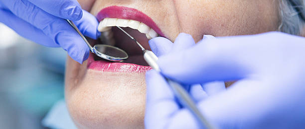 Best Emergency Dentist for Knocked-Out Tooth in Sargent, TX